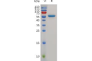 Mouse CD40 Protein, hFc Tag on SDS-PAGE under reducing condition.
