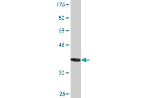 Western Blot detection against Immunogen (37. (NUAK2 抗体  (AA 521-628))