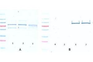 Western Blotting (WB) image for anti-V-Akt Murine Thymoma Viral Oncogene Homolog 1 (AKT1) (Ser473) antibody (ABIN400784) (AKT1 抗体  (Ser473))