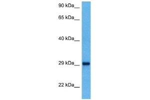 Host:  Mouse  Target Name:  YWHAQ  Sample Tissue:  Mouse Kidney  Antibody Dilution:  1ug/ml (14-3-3 theta 抗体  (N-Term))