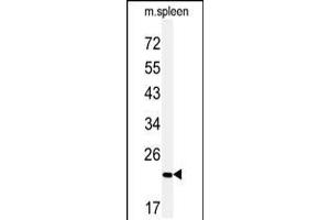 Western blot analysis of COPZ2 Antibody in mouse spleen tissue lysates (35ug/lane) (COPZ2 抗体  (C-Term))