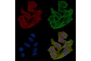 ABIN6261753 and ABIN6276862 staining Hela cells(30 min of UV treatment) by IF/ICC. (FKBP1A 抗体  (N-Term))