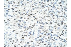 Matrin 3 antibody was used for immunohistochemistry at a concentration of 4-8 ug/ml to stain Myocardial cells (arrows) in Human Heart. (MATR3 抗体  (N-Term))