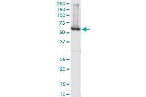 Western Blotting (WB) image for anti-serpin Peptidase Inhibitor, Clade A (Alpha-1 Antiproteinase, Antitrypsin), Member 10 (SERPINA10) (AA 22-444) antibody (ABIN565547)