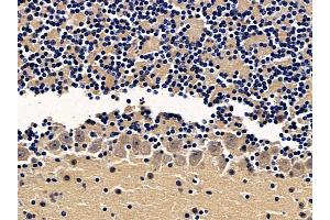 ABIN7094065 and ABIN7098109 at 1/100 staining mouse brain tissue by IHC-P. (AP2B1 抗体  (N-Term))