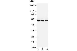 Western blot testing of Angiotensinogen antibody and Lane 1:  mouse liver;  2: rat liver;  3: rat heart
