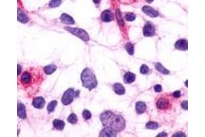 Immunocytochemistry (ICC) image for anti-Prostaglandin F Receptor (FP) (PTGFR) (Extracellular Domain) antibody (ABIN1049263)