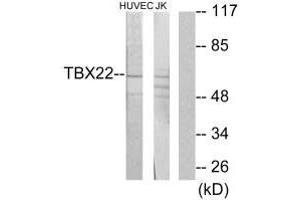 Western blot analysis of extracts from HUVEC cells and Jurkat cells, using TBX22 antibody. (T-Box 22 抗体  (N-Term))
