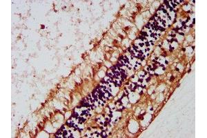 IHC image of ABIN7157984 diluted at 1:200 and staining in paraffin-embedded human eye tissue performed on a Leica BondTM system. (Mip (AA 220-263) 抗体)