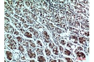 Immunohistochemistry (IHC) analysis of paraffin-embedded Human Stomach, antibody was diluted at 1:100. (PPP1R15B 抗体  (Internal Region))