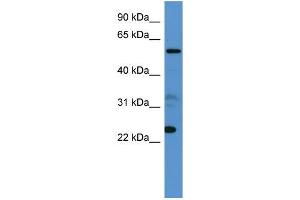 Human 721_B; WB Suggested Anti-CPNE9 Antibody Titration: 0. (CPNE9 抗体  (C-Term))