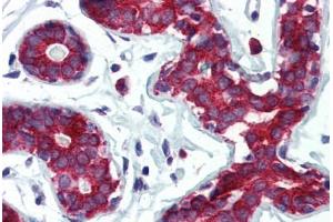 Human Breast (formalin-fixed, paraffin-embedded) stained with TPD52L1 antibody ABIN364314 at 5 ug/ml followed by biotinylated anti-mouse IgG secondary antibody ABIN481714, alkaline phosphatase-streptavidin and chromogen. (TPD52L1 抗体)