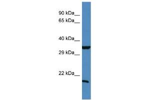 Western Blotting (WB) image for anti-TIMP Metallopeptidase Inhibitor 1 (TIMP1) (N-Term) antibody (ABIN2787966) (TIMP1 抗体  (N-Term))