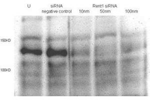 Total lysates (50ug per lane) from Hela cells untransfected (U) or transfected with negative siRNA control or Rent1 siRNAs of 10nm, 50nm to 100nm. (RENT1/UPF1 抗体  (AA 583-612))