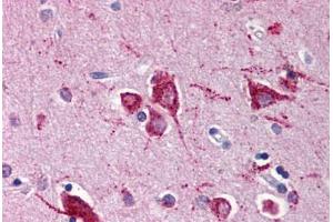 Human Brain, Cortex (formalin-fixed, paraffin-embedded) stained with RHEB antibody ABIN214467 at 5 ug/ml followed by biotinylated goat anti-rabbit IgG secondary antibody ABIN481713, alkaline phosphatase-streptavidin and chromogen. (RHEB 抗体)