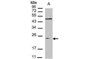 WB Image Sample(30 μg of whole cell lysate) A:293T 12% SDS PAGE antibody diluted at 1:1500 (VPS29 抗体  (C-Term))