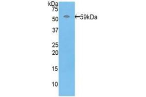 Western blot analysis of recombinant Human PRF1. (Perforin 1 抗体  (AA 32-316))
