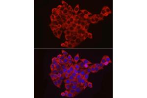 Immunofluorescence (IF) image for anti-Eukaryotic Translation Initiation Factor 4B (EIF4B) (AA 352-611) antibody (ABIN6140078)