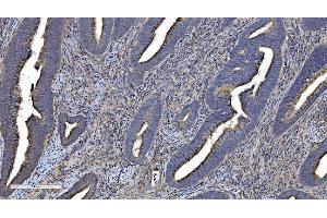 anti-Carboxymethylenebutenolidase Homolog (CMBL) (AA 1-246) antibody