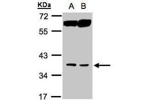 WB Image Sample(30 ug whole cell lysate) A:MOLT4 , B:Raji , 10% SDS PAGE antibody diluted at 1:1000 (ACOT8 抗体)