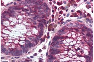 Human Colon (formalin-fixed, paraffin-embedded) stained with NOX1 antibody ABIN297329 at 10 ug/ml followed by biotinylated goat anti-rabbit IgG secondary antibody ABIN481713, alkaline phosphatase-streptavidin and chromogen. (NOX1 抗体  (C-Term))