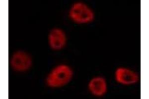 ABIN6275690 staining HUVEC by IF/ICC. (ZNF292 抗体  (Internal Region))