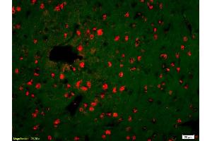 Formalin-fixed and paraffin-embedded rat brain labeled with Anti-KLK14 Polyclonal Antibody, Unconjugated (ABIN676058) 1:200, overnight at 4°C, The secondary antibody was Goat Anti-Rabbit IgG, Cy3 conjugated used at 1:200 dilution for 40 minutes at 37°C. (Kallikrein 14 抗体  (AA 201-267))