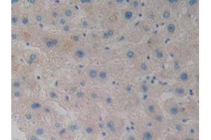 Detection of WNT3A in Human Liver Tissue using Polyclonal Antibody to Wingless Type MMTV Integration Site Family, Member 3A (WNT3A) (WNT3A 抗体  (AA 1-290))