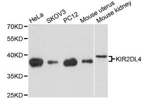 Western blot analysis of extracts of various cell lines, using KIR2DL4 antibody. (KIR2DL4/CD158d 抗体  (AA 22-242))