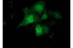 Anti-CBWD1 mouse monoclonal antibody (ABIN2452885) immunofluorescent staining of COS7 cells transiently transfected by pCMV6-ENTRY CBWD1 (RC222790). (CBWD1 抗体)
