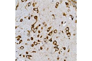 Immunohistochemistry (IHC) image for anti-Insulin Induced Gene 2 (INSIG2) (AA 50-150) antibody (ABIN7267888)