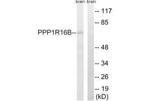 PPP1R16B Antikörper