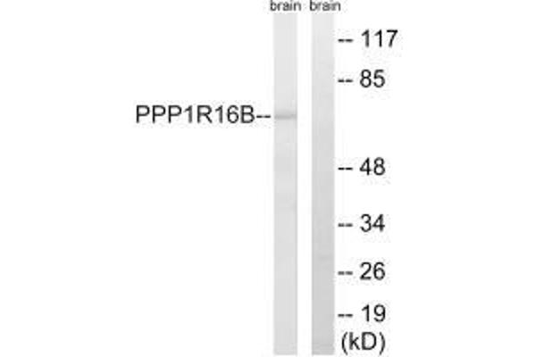 PPP1R16B Antikörper