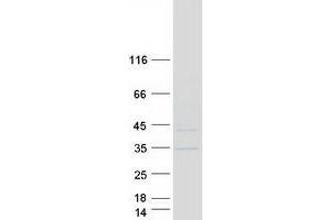 Western Blotting (WB) image for Kinetochore-Localized Astrin/SPAG5 Binding Protein (KNSTRN) (Transcript Variant 1) protein (Myc-DYKDDDDK Tag) (ABIN2718579)