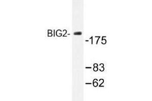 Image no. 1 for anti-ADP-Ribosylation Factor Guanine Nucleotide-Exchange Factor 2 (Brefeldin A-Inhibited) (ARFGEF2) antibody (ABIN317822) (ARFGEF2 抗体)