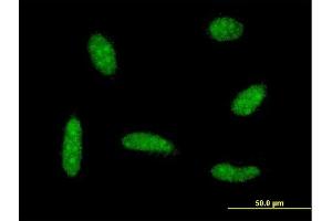 Immunofluorescence of monoclonal antibody to MEF2BNB on HeLa cell . (MEF2BNB 抗体  (AA 1-119))