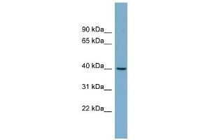 TRIM63 antibody used at 1 ug/ml to detect target protein. (TRIM63 抗体  (Middle Region))