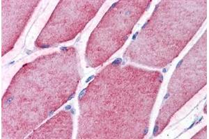 Human Skeletal Muscle: Formalin-Fixed, Paraffin-Embedded (FFPE) (TCTN2 抗体  (C-Term))