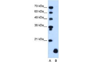 WB Suggested Anti-PLP2 Antibody Titration:  1. (PLP2 抗体  (Middle Region))