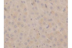 Detection of NPPA in Rat Liver Tissue using Polyclonal Antibody to Natriuretic Peptide Precursor A (NPPA) (NPPA 抗体  (AA 25-152))