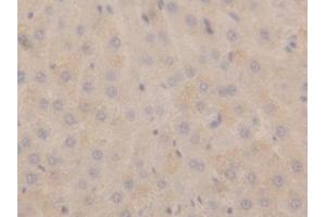 Detection of NPPA in Rat Liver Tissue using Polyclonal Antibody to Natriuretic Peptide Precursor A (NPPA)