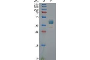 Human CXCR3 Protein, hFc Tag on SDS-PAGE under reducing condition. (CXCR3 Protein (Fc Tag))