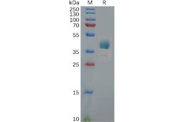 CXCR3 Protein (Fc Tag)