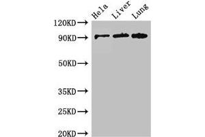 Western Blot Positive WB detected in: Hela whole cell lysate, Mouse liver tissue, Mouse lung tissue All lanes: CPT1C antibody at 2. (CPT1C 抗体  (AA 699-803))