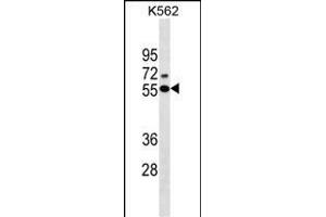 ESR2 Antibody (Center)(Ascites) ABIN1537698 western blot analysis in K562 cell line lysates (35 μg/lane). (ESR2 抗体  (AA 369-397))