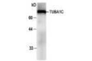 Image no. 1 for anti-Tubulin, alpha 1c (TUBA1C) antibody (ABIN791483) (TUBA1C 抗体)