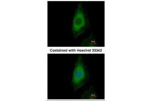 ICC/IF Image Immunofluorescence analysis of paraformaldehyde-fixed HeLa, using PP2A beta, antibody at 1:500 dilution. (PPP2CB 抗体  (Center))