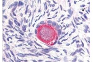 Image no. 1 for anti-delta-Like 4 (DLL4) (Internal Region) antibody (ABIN199951) (DLL4 抗体  (Internal Region))