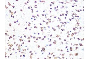 Immunohistochemistry of paraffin-embedded rat brain using THOC4/THOC4/ALYREFREF Rabbit mAb (ABIN1679512, ABIN3018793, ABIN3018794 and ABIN7101662) at dilution of 1:100 (40x lens). (THO Complex 4 抗体)