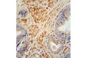 Immunohistochemistry (Paraffin-embedded Sections) (IHC (p)) image for anti-Follistatin-Like 1 (FSTL1) (AA 285-318), (C-Term) antibody (ABIN952355)